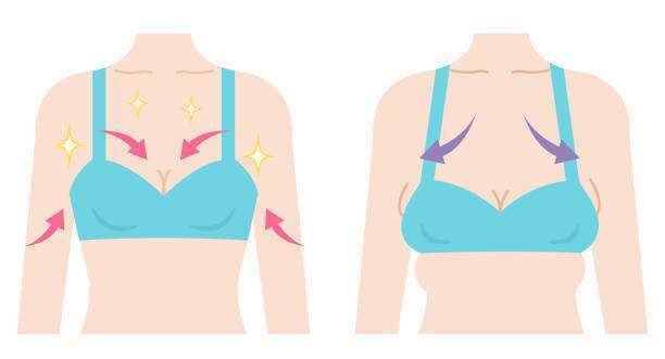 The Complete Guide To Sagging Breasts and Related Issues